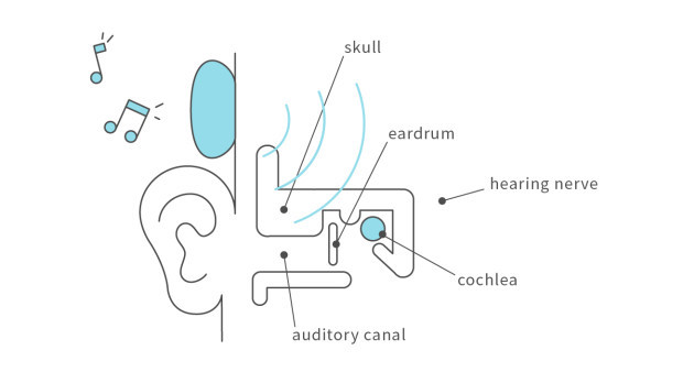 bone conduction kopfh%C3%B6rer