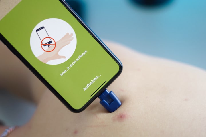 heat_it: Stichheiler für mobile Anwendung | Android + iOS | inkl. Test